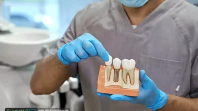 ایمپلنت برای چه کسانی مناسب نیست؟