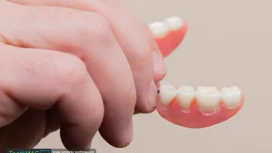 پروتز متحرک چیست و در چه مواقعی مورد استفاده قرار می گیرد؟